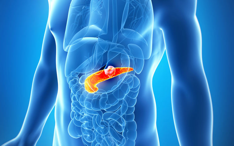 ถอดบทเรียนจากกรณีศึกษา: มะเร็งตับอ่อน ภัยเงียบที่คาดไม่ถึง