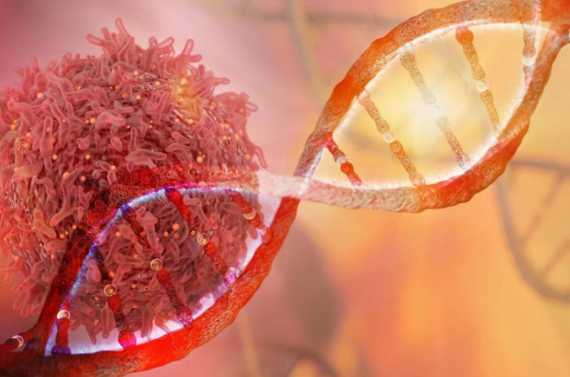 ตัวการเบื้องหลังคือสิ่งนี้? ผลวิจัยสหรัฐฯ เผยยีนกุญแจสำคัญที่ทำให้มะเร็งตับอ่อนแพร่กระจาย